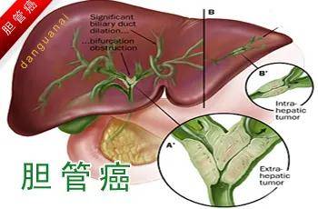 郑大干细胞 免疫细胞存储，让生命多备一份战斗武器